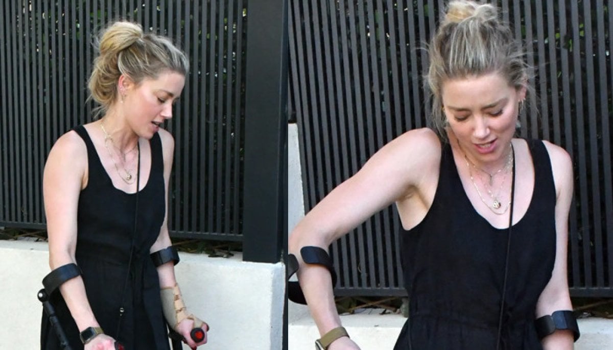Amber Heard spotted limping on crutches after sustaining hip injury 