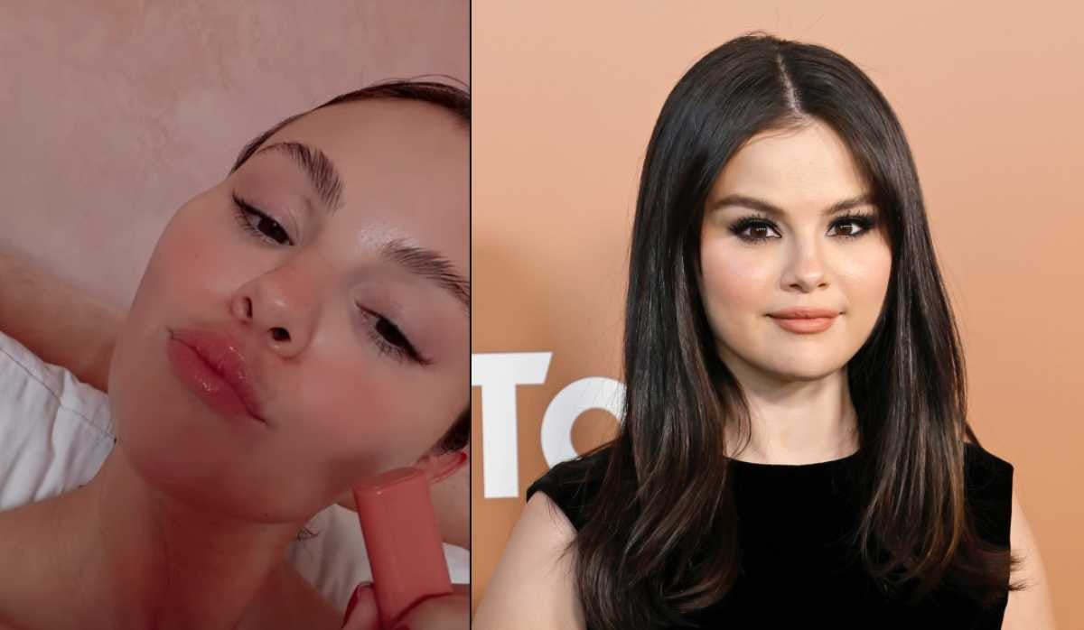 Selena Gomez explains pigmentation amid fans' harsh comment