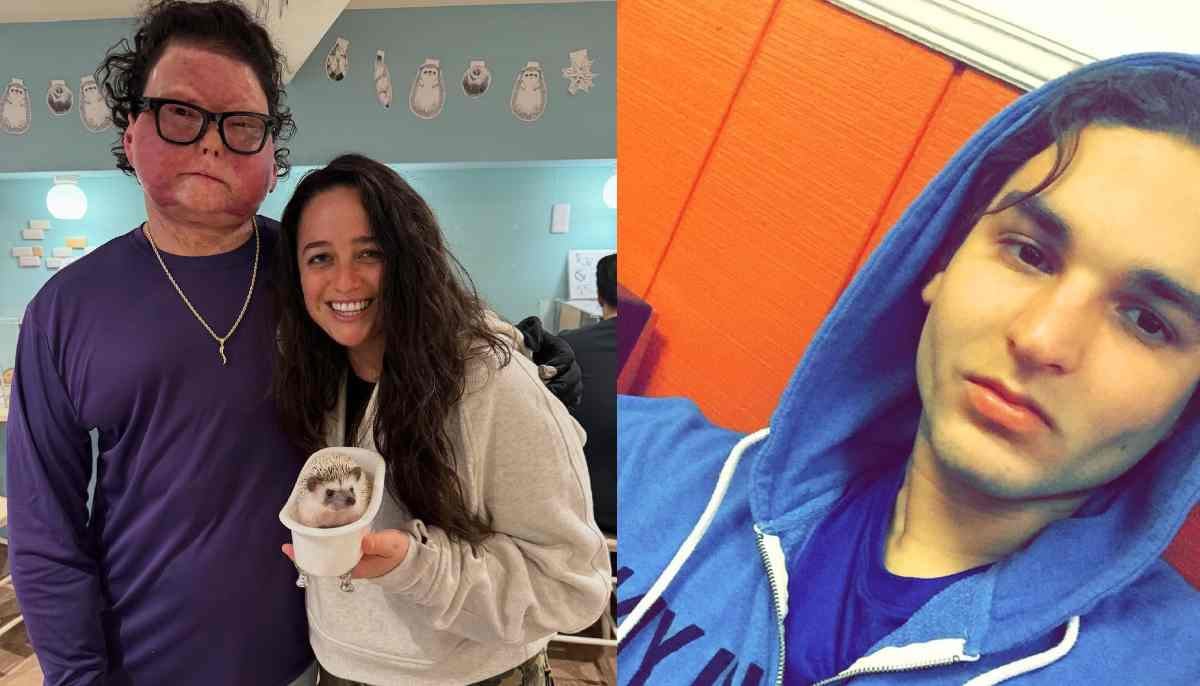 All about Joe DiMeo's face transplant and journey of survival