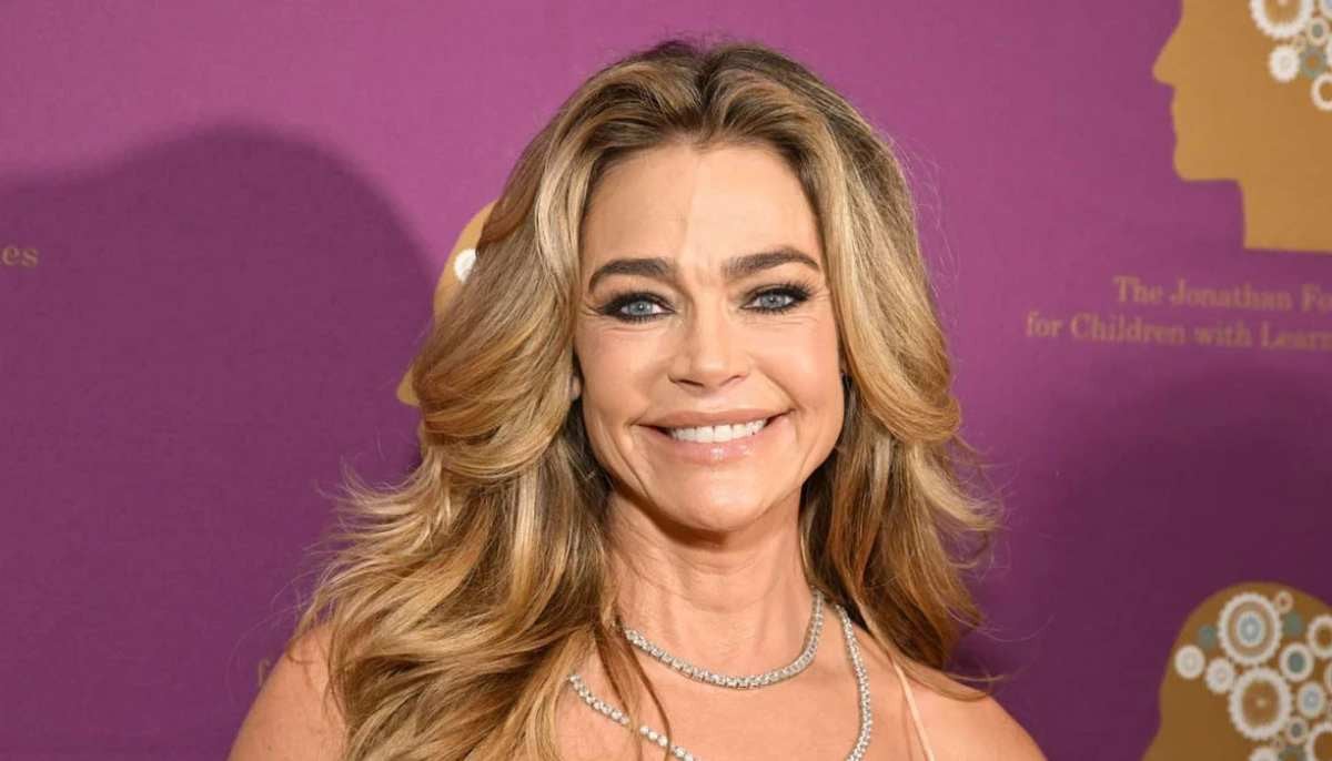 Denise Richards gets candid about plastic surgery