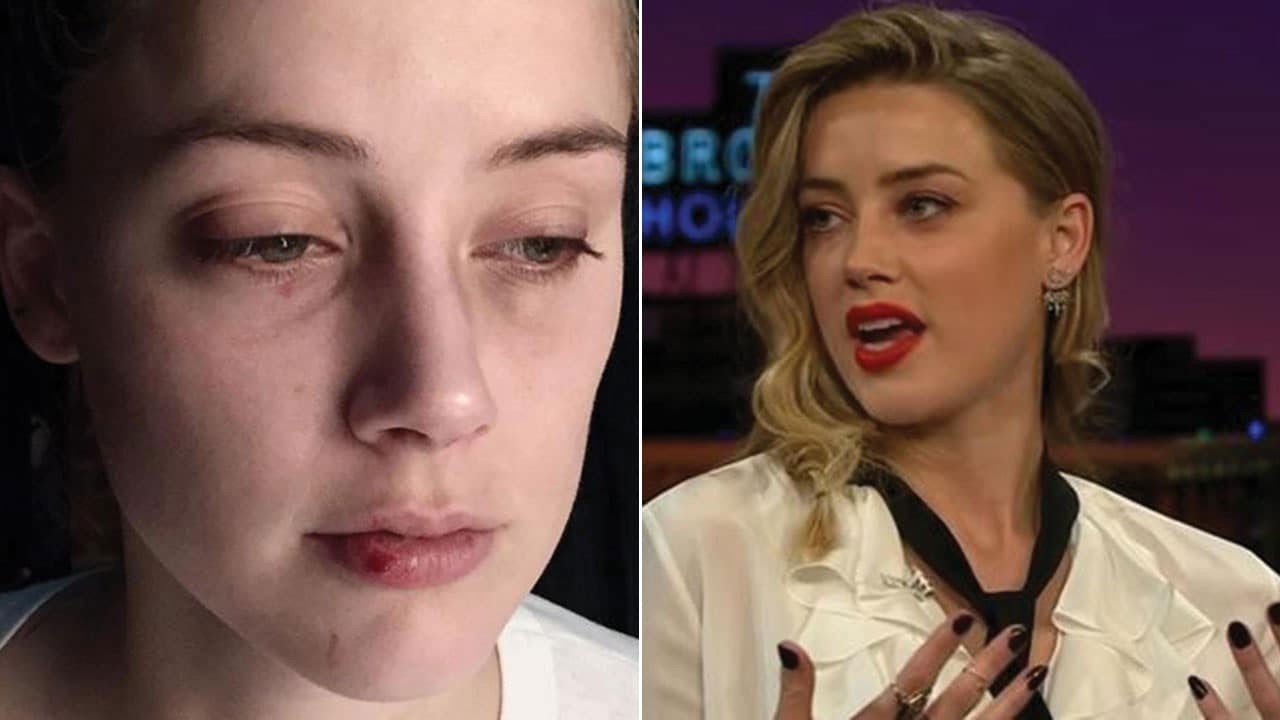 Johnny Depp libel trial: Amber Heard hid her bruises under makeup before appearing on James
