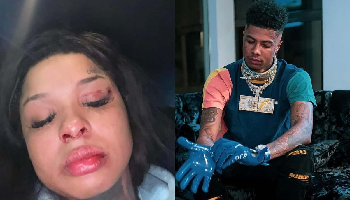 Blueface’s girlfriend Chrisean Rock takes back abuse claims