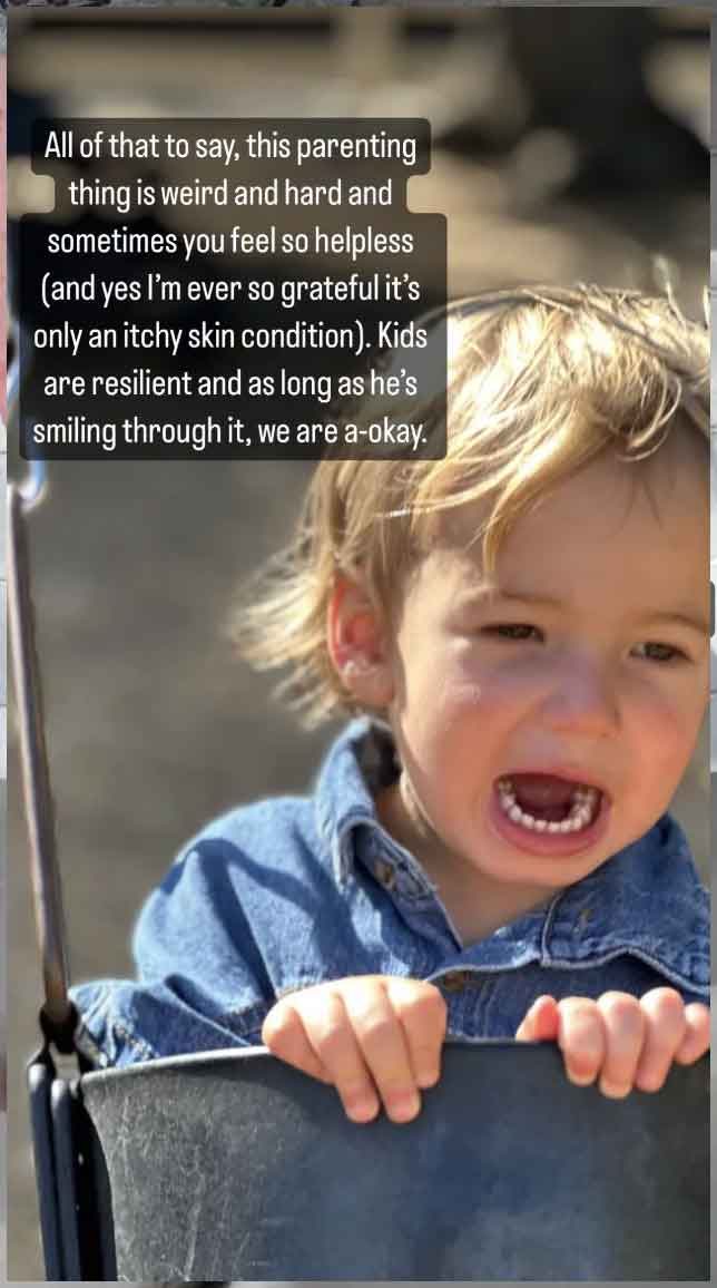Helpless Mandy Moore reveals 2-year-old son is diagnosed with skin syndrome