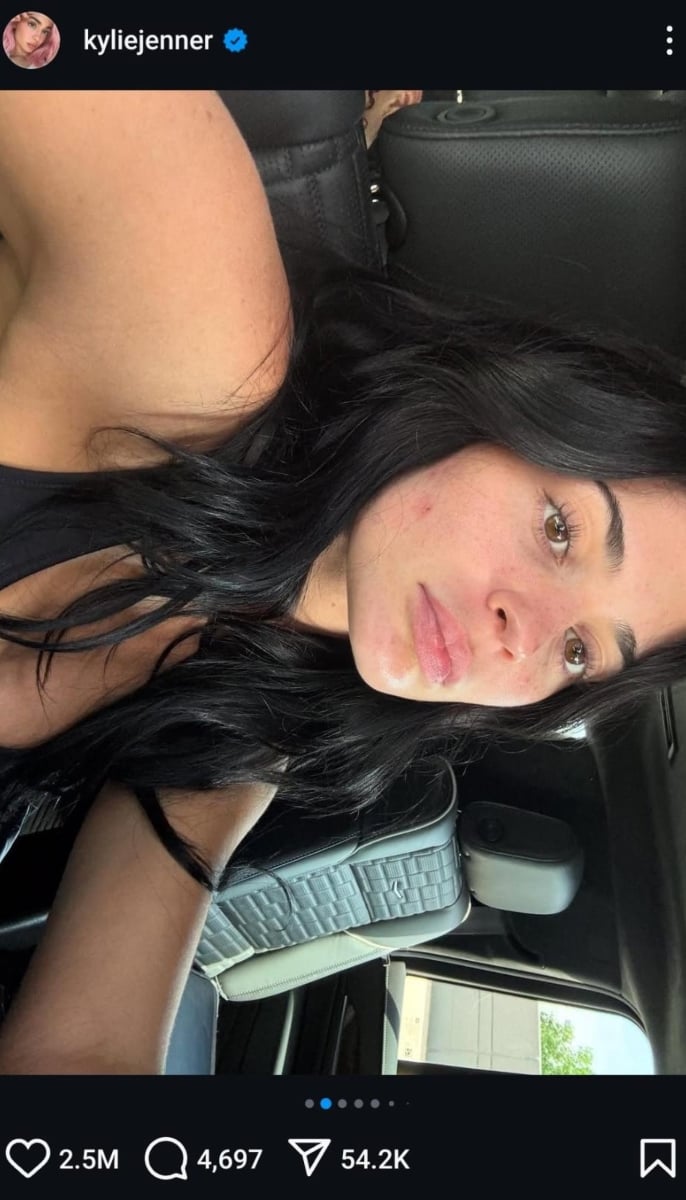 Kylie Jenner embraces pimple in makeup free selfie