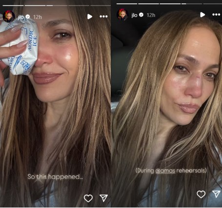 Jennifer Lopez suffers major blow ahead of American Music Awards 2025