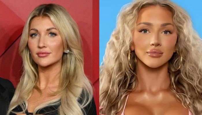 Love Island USAs Vanna Einerson addresses plastic surgery rumours