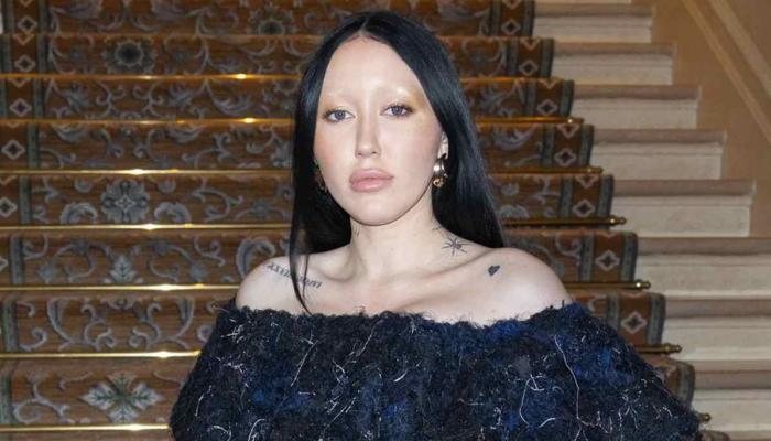 Miley Cyrus’s sister Noah’s new look sparks surgery speculations