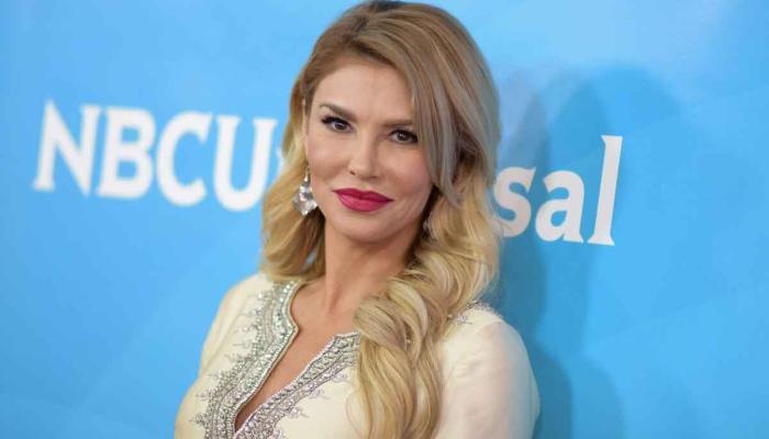 Brandi Glanville gets horrific chemical burns on face: watch