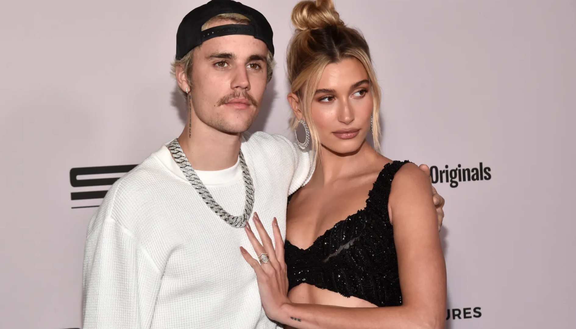 Hailey Bieber furious over Botox allegations: ‘Ive never touched my face’