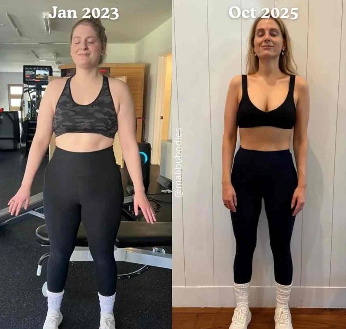 Meghan Trainor sparks buzz with new transformation