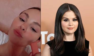 Selena Gomez explains pigmentation amid fans' harsh comment