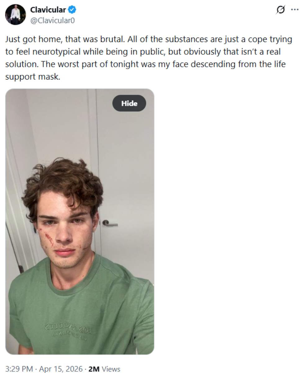 Clavicular breaks silence after overdose, confirms show