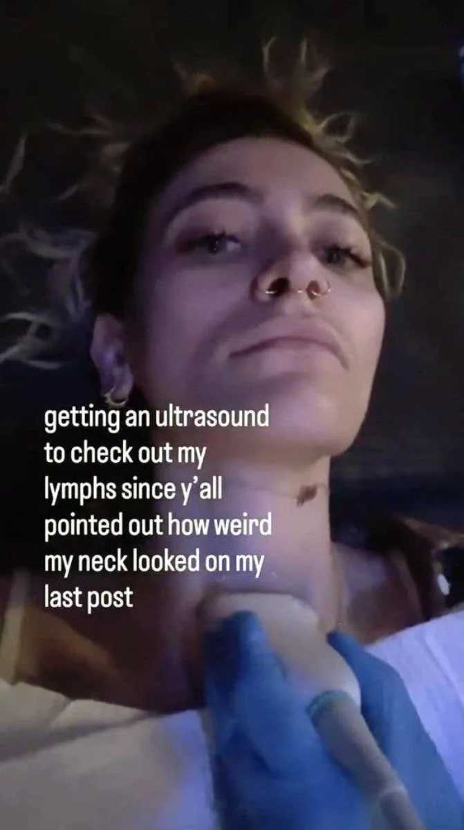 Paris Jackson explains ‘weird neck’ after fans raise concern