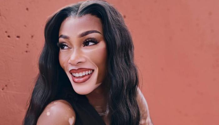 Winnie Harlow turns heads during stylish night out