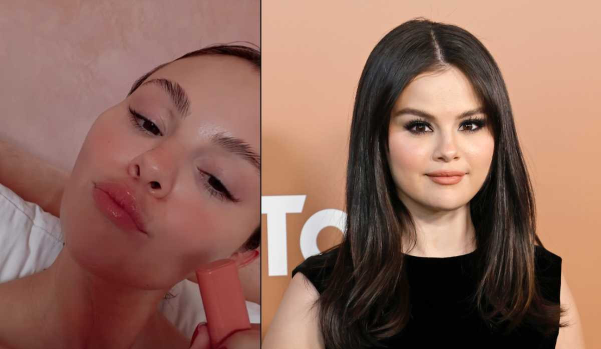 Selena Gomez explains pigmentation amid fans' harsh comment